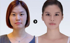 整形费用,揭秘不同项目与医院的价格差异