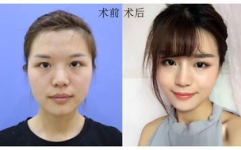 北京基础美整形,专业塑美之旅，定制您的美丽人生
