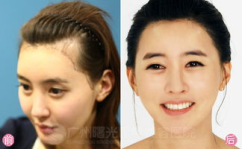 中国最好的美容整形医院,权威医院盘点与推荐