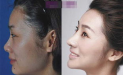 女性整形,重塑自信，焕发美丽风采